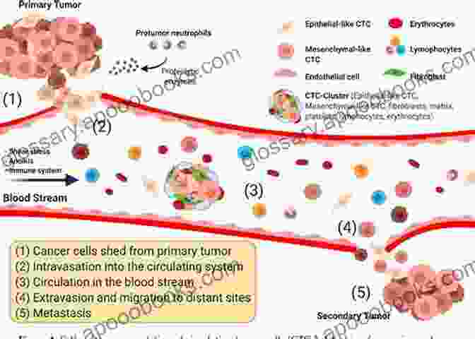 Challenges In Tumor Classification Controversies In Neuro Oncology: Best Evidence Medicine For Brain Tumor Surgery