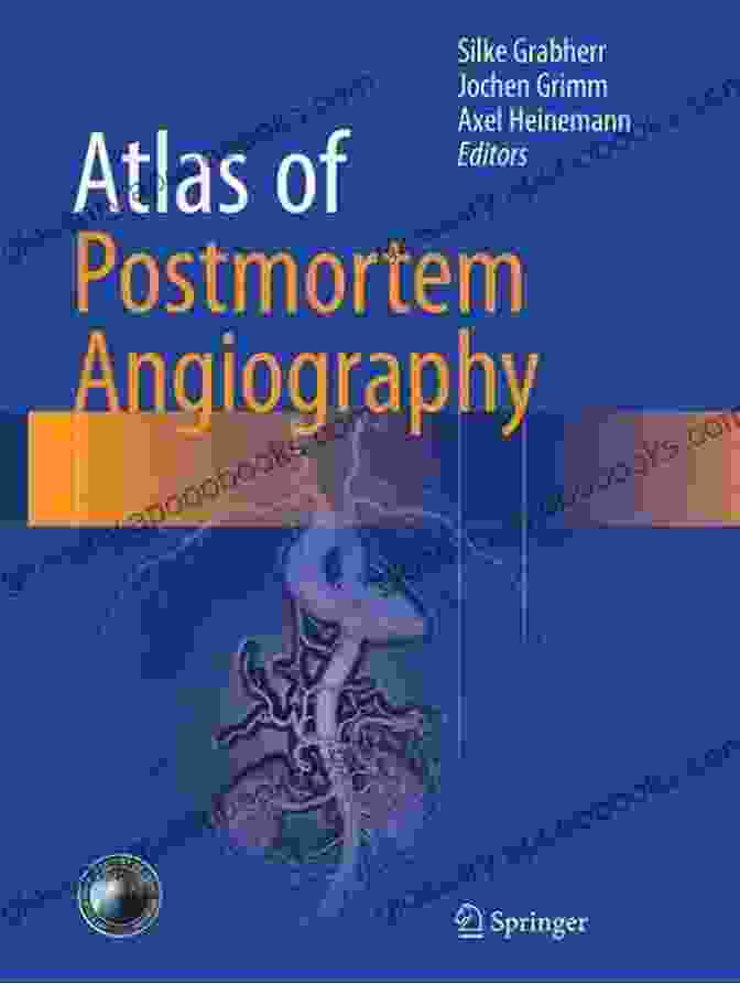 Cover Of The 'Atlas Of Postmortem Angiography' By Edward Gaily, Featuring An Anatomical Illustration Of The Vascular System. Atlas Of Postmortem Angiography Edward Gaily