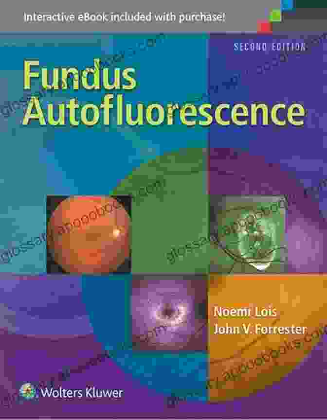 Fundus Autofluorescence Book Cover By Edward Gaily Fundus Autofluorescence Edward Gaily