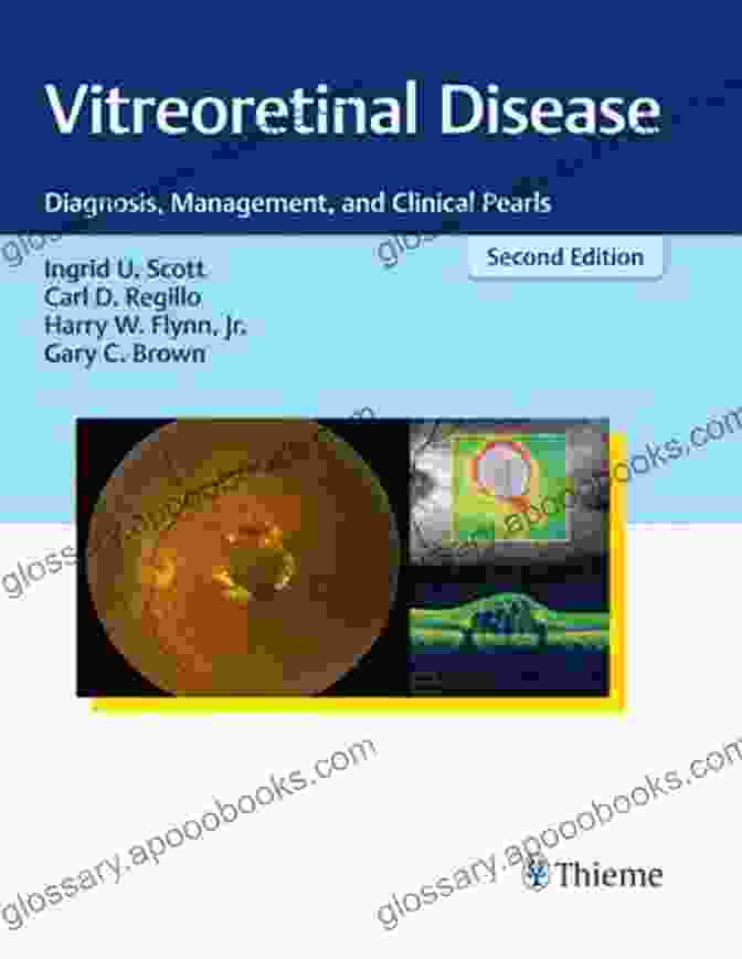 Medical Management Of Vitreoretinal Diseases Management Of Complicated Vitreoretinal Diseases