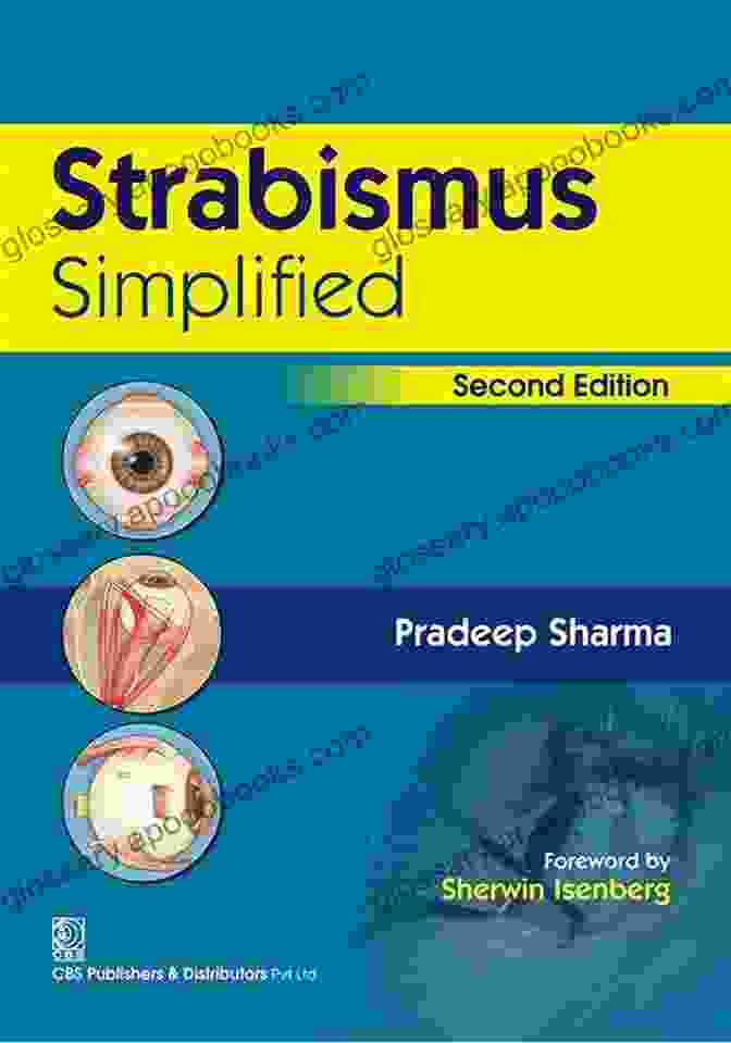 Strabismus Management Strategies Strabismus Simplified Second Edition Mosby