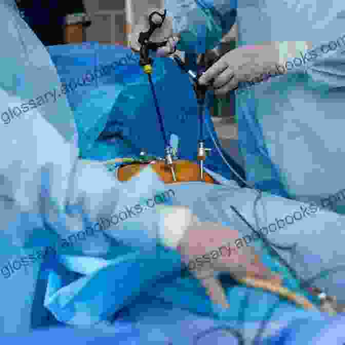 Surgeon Performing An Endoscopic Procedure Recent Advances In Minimal Access Surgery