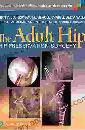 The Adult Hip: Hip Preservation Surgery